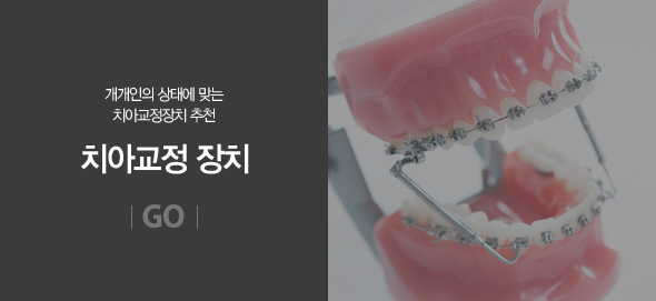 치아교정 장치